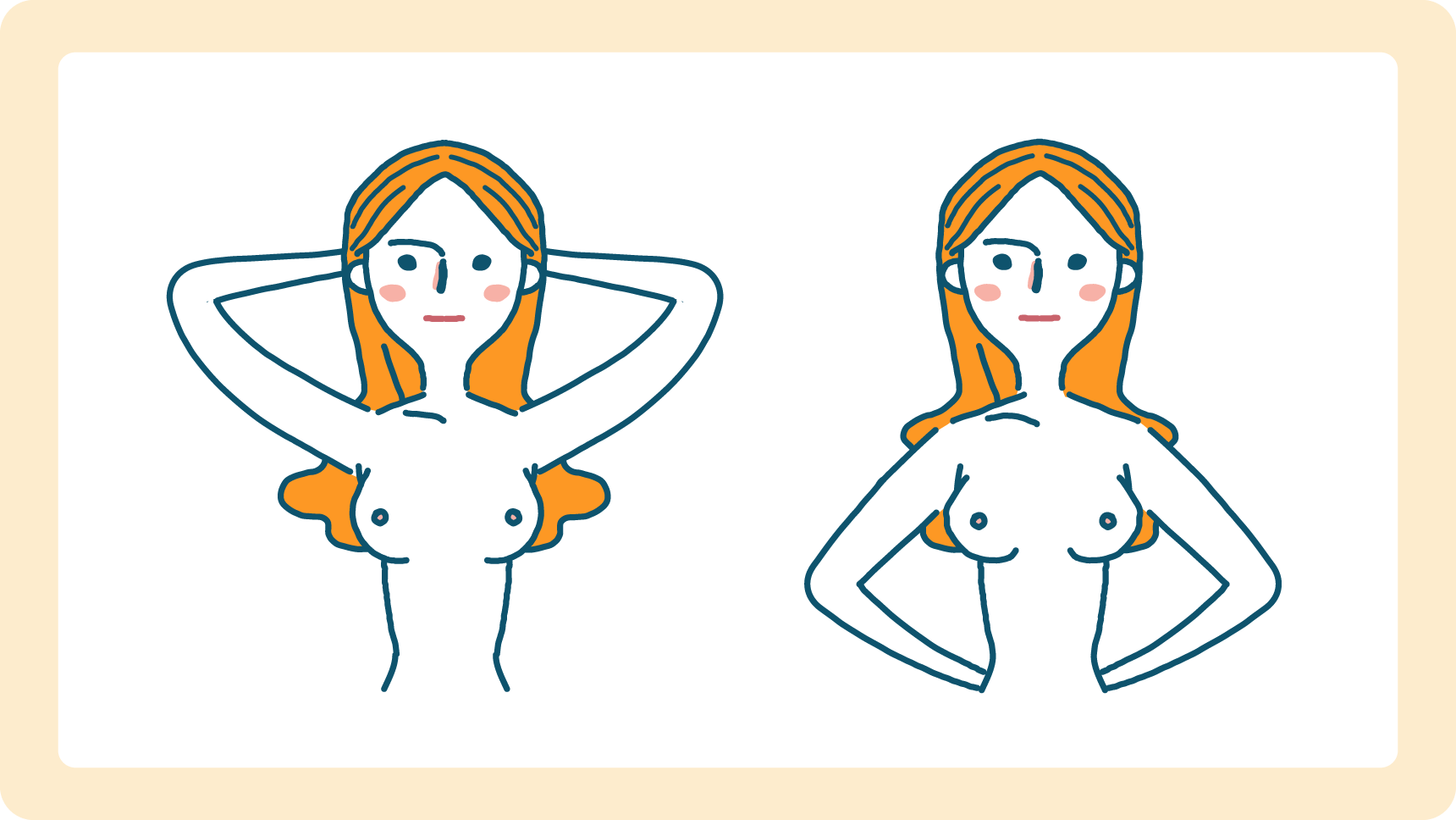 立った状態で、それぞれ腕を上下させた女性の乳房のしこりがないか確認する女性のイラスト